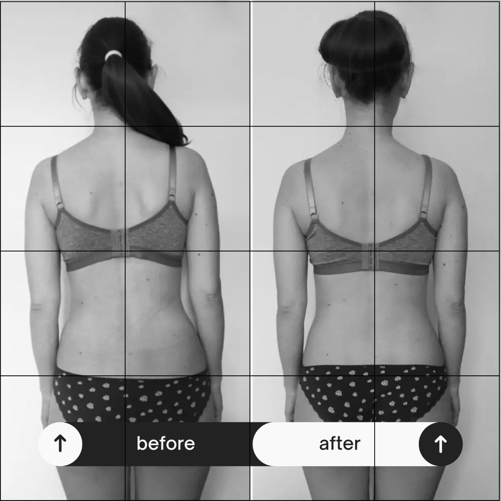 Posture transformation — back view alignment, subject 1