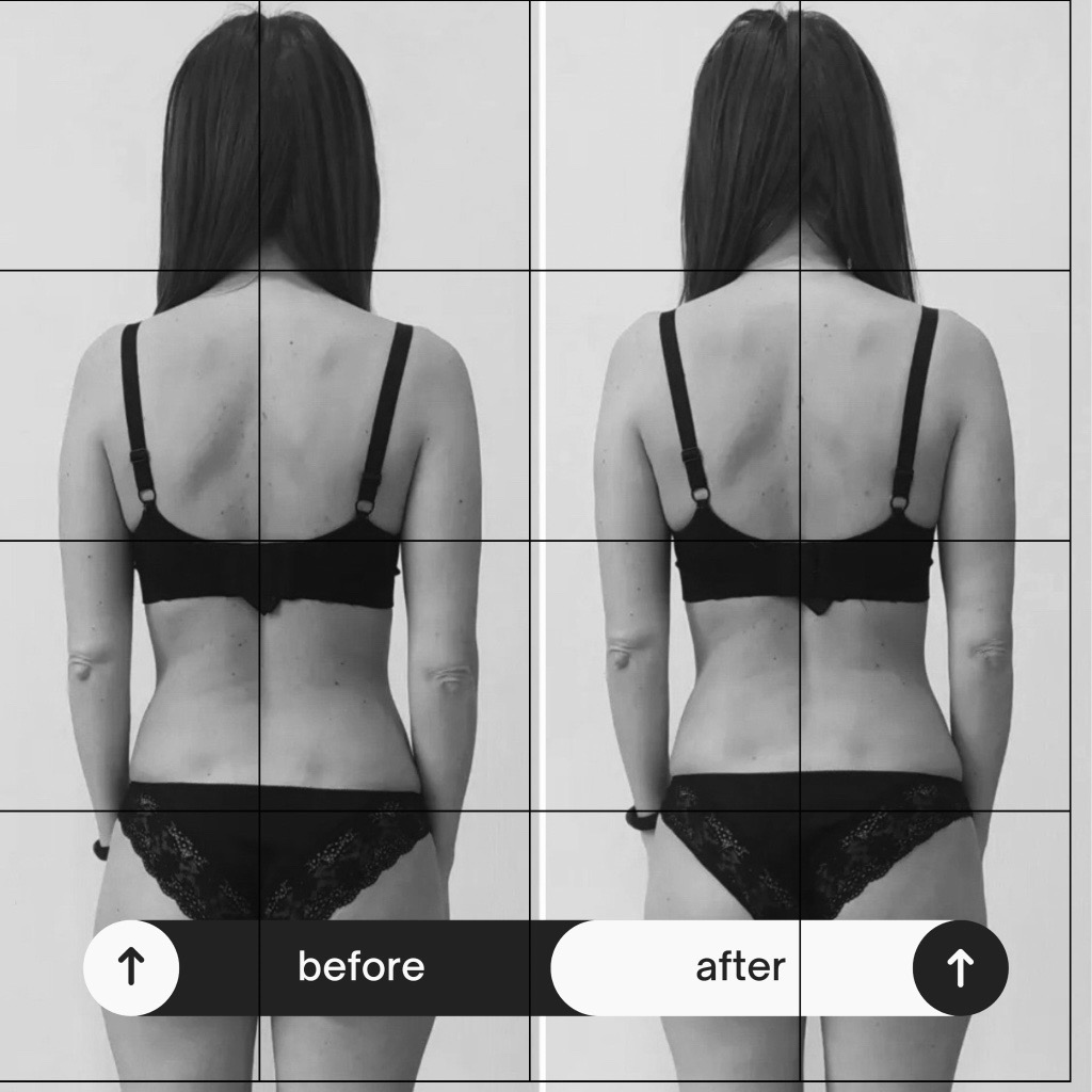 Posture transformation — back view alignment, subject 2