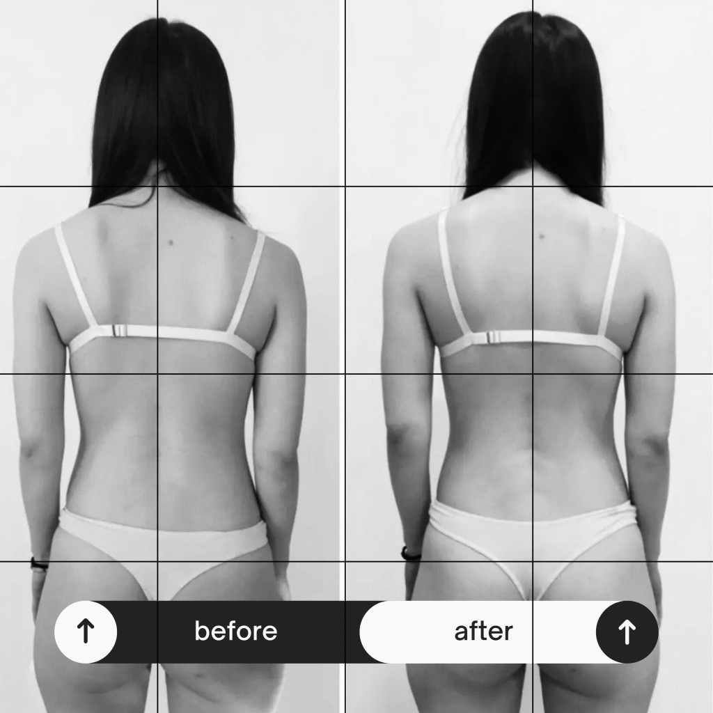Posture transformation — back view alignment, subject 3